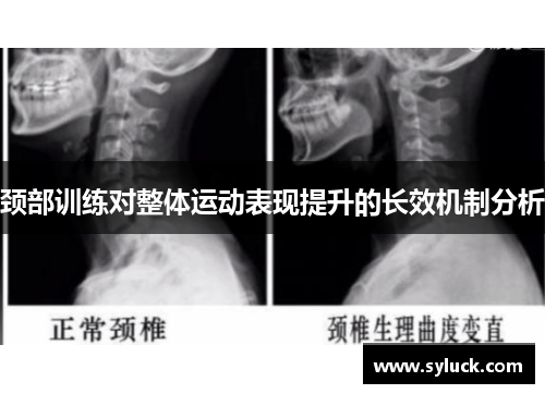 颈部训练对整体运动表现提升的长效机制分析